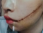 Quảng Ninh: Điều tra thông tin nữ sinh lớp 11 bị rạch mặt trong nhà vệ sinh nhà trường-2