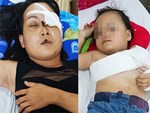 Tai nạn liên hoàn ở đường tránh Đà Nẵng, tuyến Bắc-Nam tê liệt-4