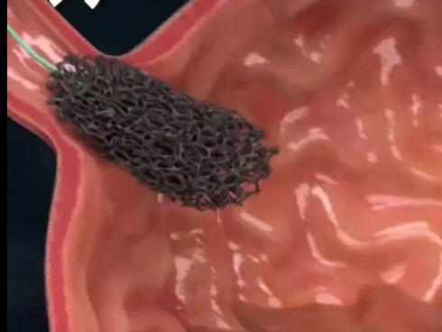 Phát hiện căn bệnh tình dục lây nhiễm cả khi không quan hệ-2