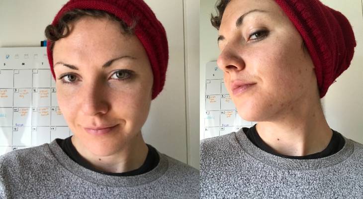 Ngắm kết quả sau khi uống nước ép cần tây của các cô gái trên thế giới: làn da thay đổi nhiều đến mức khó tin-1