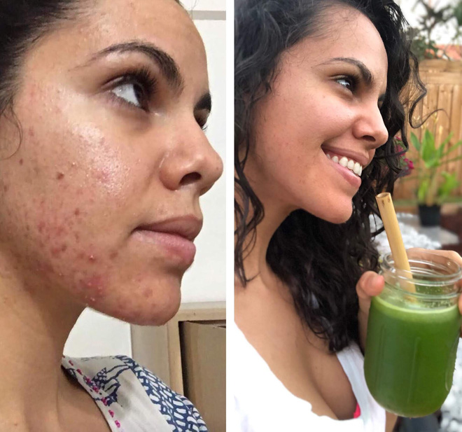Ngắm kết quả sau khi uống nước ép cần tây của các cô gái trên thế giới: làn da thay đổi nhiều đến mức khó tin-3
