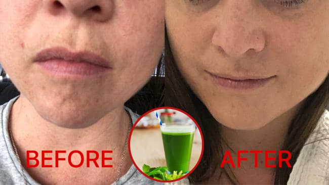 Ngắm kết quả sau khi uống nước ép cần tây của các cô gái trên thế giới: làn da thay đổi nhiều đến mức khó tin-4