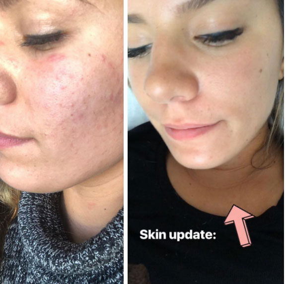 Ngắm kết quả sau khi uống nước ép cần tây của các cô gái trên thế giới: làn da thay đổi nhiều đến mức khó tin-5