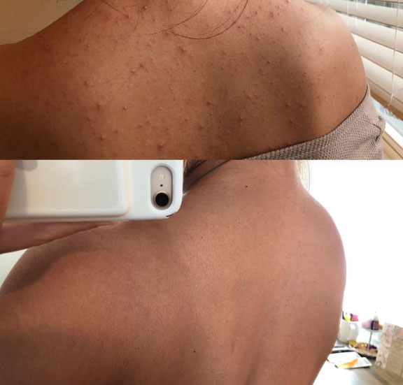 Ngắm kết quả sau khi uống nước ép cần tây của các cô gái trên thế giới: làn da thay đổi nhiều đến mức khó tin-6