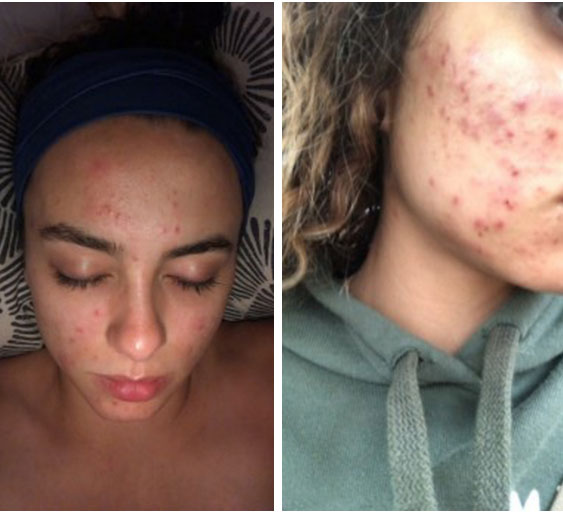 Ngắm kết quả sau khi uống nước ép cần tây của các cô gái trên thế giới: làn da thay đổi nhiều đến mức khó tin-7