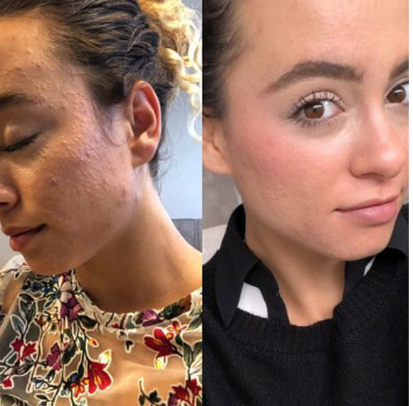 Ngắm kết quả sau khi uống nước ép cần tây của các cô gái trên thế giới: làn da thay đổi nhiều đến mức khó tin-8