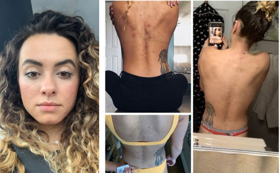 Ngắm kết quả sau khi uống nước ép cần tây của các cô gái trên thế giới: làn da thay đổi nhiều đến mức khó tin-9