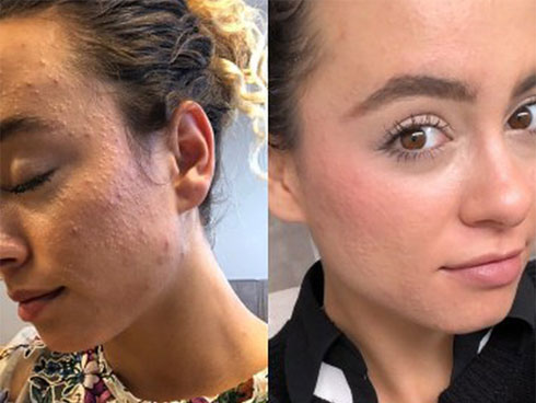 Công thức nước ép cần tây vừa dễ uống lại tăng gấp bội công dụng giảm cân, đẹp da của Châu Bùi-1