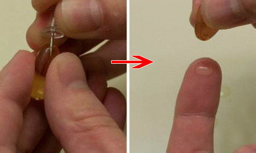 Mặt rỗ như tổ ong bầu cũng được lấp đầy nếu bạn làm việc này mỗi tối-8