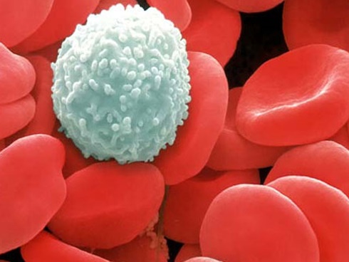 Dấu hiệu sốt virus ở trẻ sơ sinh: Bố mẹ chủ quan có thể khiến con mất mạng vì nhiều biến chứng nguy hiểm-3