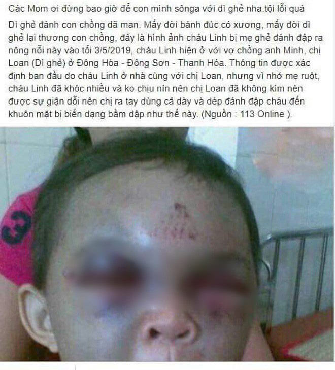 Thực hư thông tin bé trai ở Thanh Hóa bị dì ghẻ đánh đập thâm tím mặt vì… nhớ mẹ-1