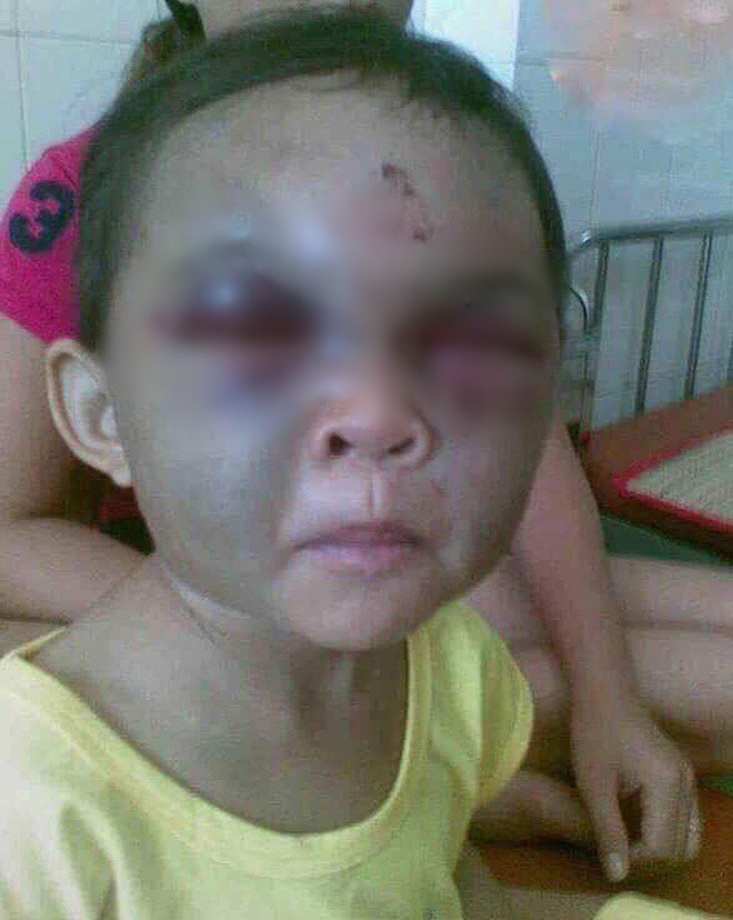 Thực hư thông tin bé trai ở Thanh Hóa bị dì ghẻ đánh đập thâm tím mặt vì… nhớ mẹ-2