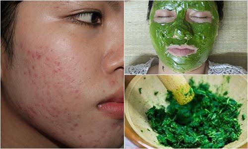 Mặt rỗ như tổ ong bầu cũng được lấp đầy nếu bạn làm việc này mỗi tối-5