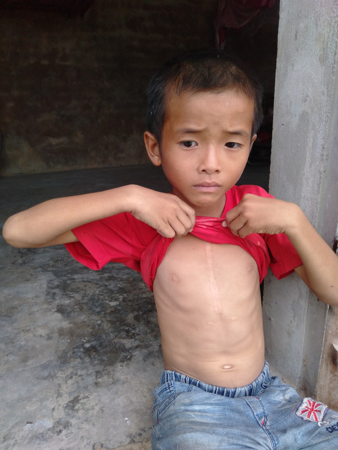 Bé trai 9 tuổi không có bố, mắc bệnh tim đau đớn nhìn mẹ cận kề cái chết: Cháu sẽ sống sao nếu không còn mẹ?”-5