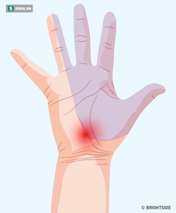 3 dấu hiệu bất thường ở tay chân: 80% khả năng bạn bị tắc mạch máu, nên xử lý ngay-4