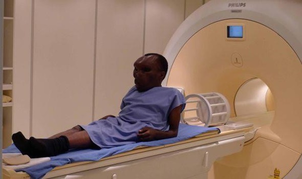 Hành trình trở thành ngôi sao của người đàn ông mắc bệnh ‘mặt rắn’-3