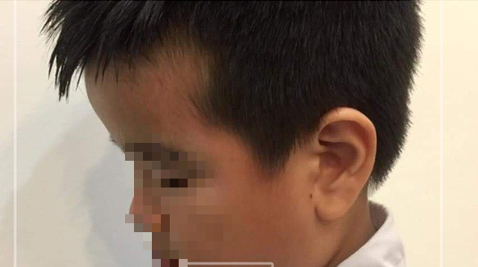 Hiệu trưởng lên tiếng vụ giáo viên tát học sinh bầm mặt trong giờ kiểm tra: Cần có hình thức kỷ luật cao hơn với cô giáo-2