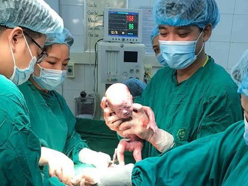 Người mẹ mang thai 5 cực hiếm, lúc lâm bồn các bác sĩ choáng váng khi nhìn thấy điều này vào phút cuối-3