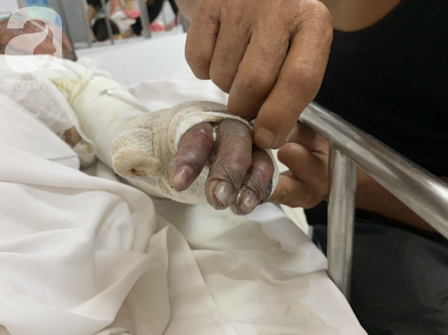 Bố dùng xăng đốt khiến mẹ biến dạng khuôn mặt, con gái 8 tuổi khóc ngất: Mẹ có xấu nhưng con vẫn nhận ra mẹ mà-7