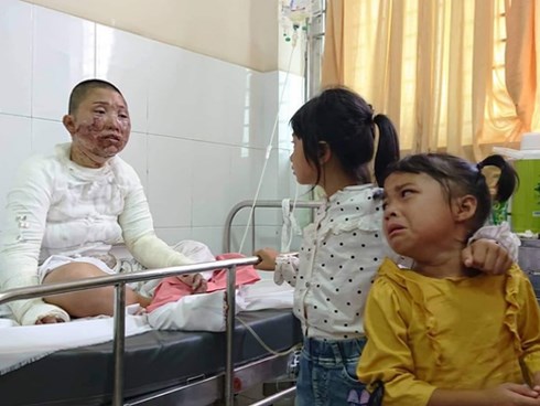 Bố dùng xăng đốt khiến mẹ biến dạng khuôn mặt, con gái 8 tuổi khóc ngất: