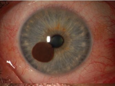 Hoảng sợ tột độ khi bất ngờ khóc ra máu: Câu chuyện kinh hoàng của người đàn ông hoàn toàn khỏe mạnh-2