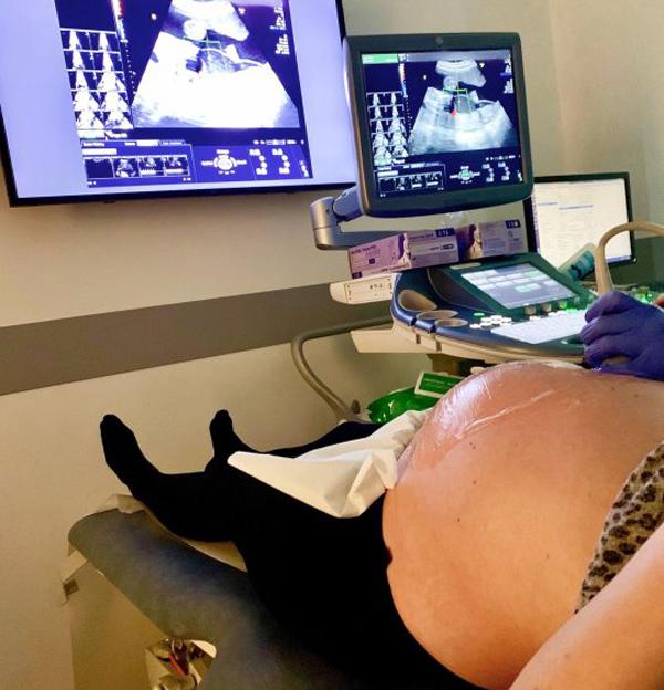 Biết thai đã chết lưu, mẹ vẫn cố mang bầu tiếp vì lý do này-1