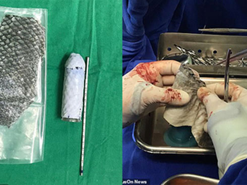 Tai nạn phòng the: Học theo phim bạo dâm và những hệ lụy ám ảnh cả đời-4