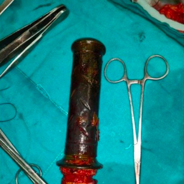 Đi khám vì bị đau bụng, người phụ nữ vô tình tiết lộ hành vi tàn độc của người chồng từ tận 2 năm trước-2