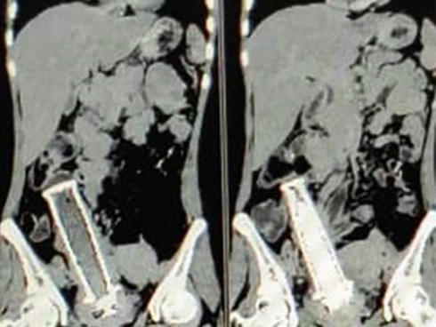 Bi kịch của nghiên cứu sinh con nhà người ta: Âm thầm đầu độc 2 bạn học bằng chai nước giải khát và lời thú nhận khiến nhiều cha mẹ phải suy ngẫm-5