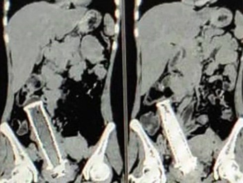 Đi khám vì bị đau bụng, người phụ nữ vô tình tiết lộ hành vi tàn độc của người chồng từ tận 2 năm trước