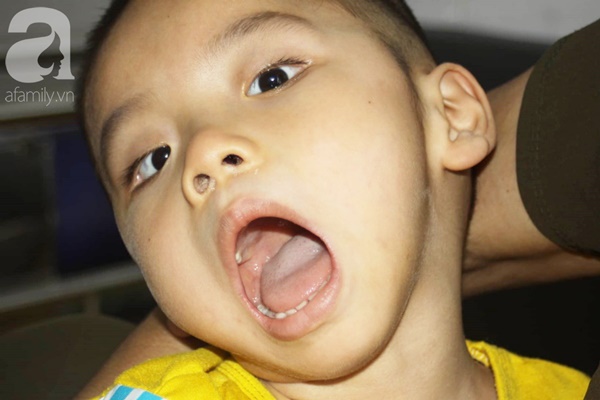 Biết con trai 5 tuổi bị bại não, mẹ nhẫn tâm bỏ đi để lại con cho bà nội già yếu mà không có tiền cứu chữa-10