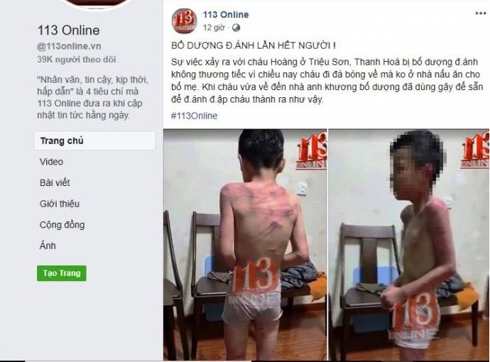 Xác minh thông tin cháu bé bị bố dượng hành hung dã man tại Thanh Hóa-1