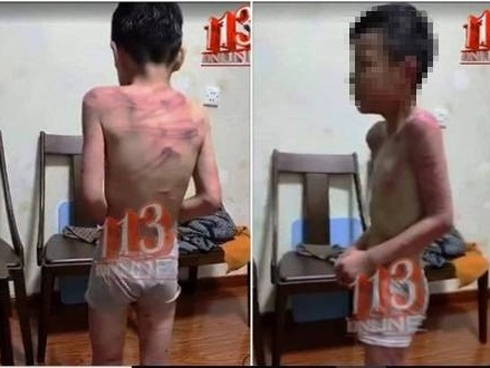 Nghi vấn người phụ nữ tâm thần bị hiếp dâm mang thai đến 8 tháng-2