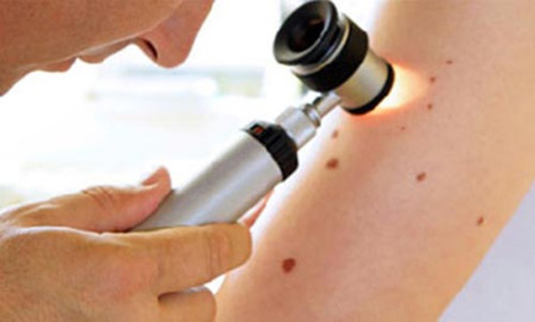 Chuyên gia tiết lộ 10 báo động đỏ trên cơ thể chứng tỏ ung thư đang đến gần-3