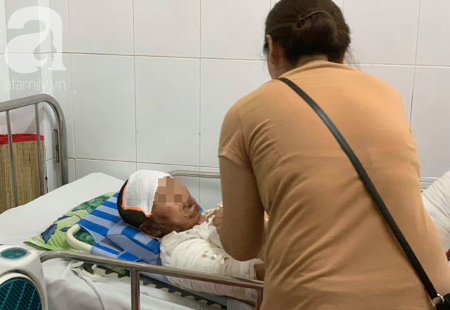 Phẫn nộ: Chồng nhậu say rồi về gây sự, mua xăng đốt vợ khiến nạn nhân bị bỏng nặng-2