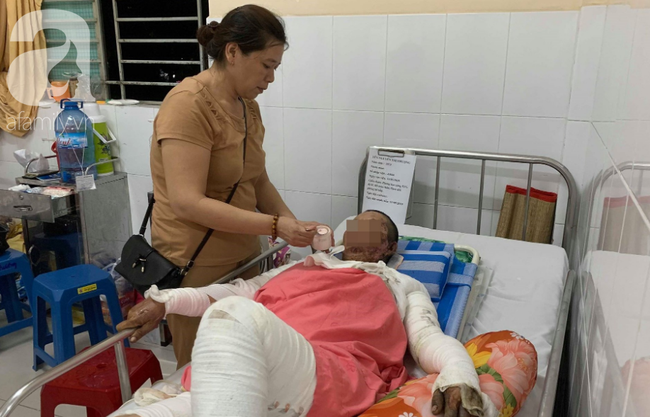 Phẫn nộ: Chồng nhậu say rồi về gây sự, mua xăng đốt vợ khiến nạn nhân bị bỏng nặng-5