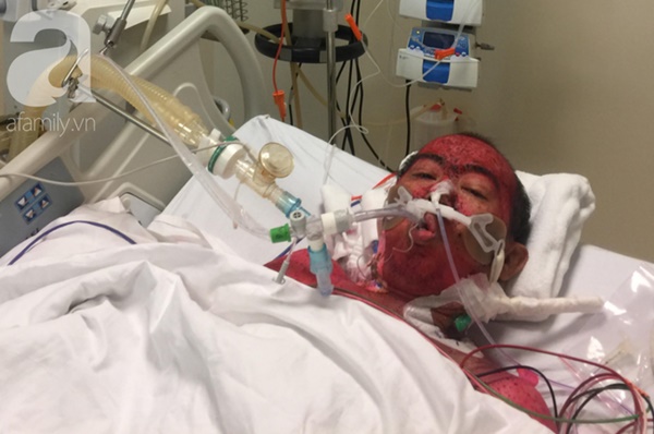 Một người đàn ông suy hô hấp, hôn mê nguy kịch vì thói quen mua thuốc mà hầu như ai cũng mắc phải-1