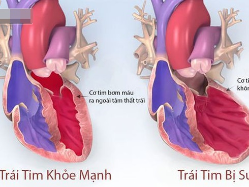 2 người phụ nữ tử vong sau khi ăn hải sản: Hãy cẩn trọng và đừng bao giờ ăn hải sản kiểu này-3