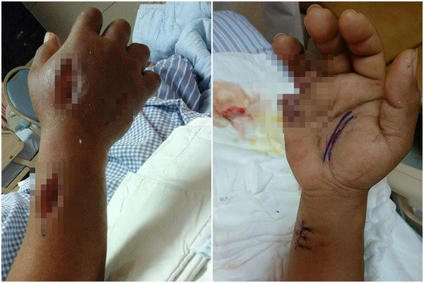 2 người phụ nữ tử vong sau khi ăn hải sản: Hãy cẩn trọng và đừng bao giờ ăn hải sản kiểu này-2