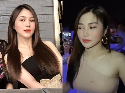 Hương Tràm lại vướng nghi án tu sửa nhan sắc trước khi sang Mỹ du học
