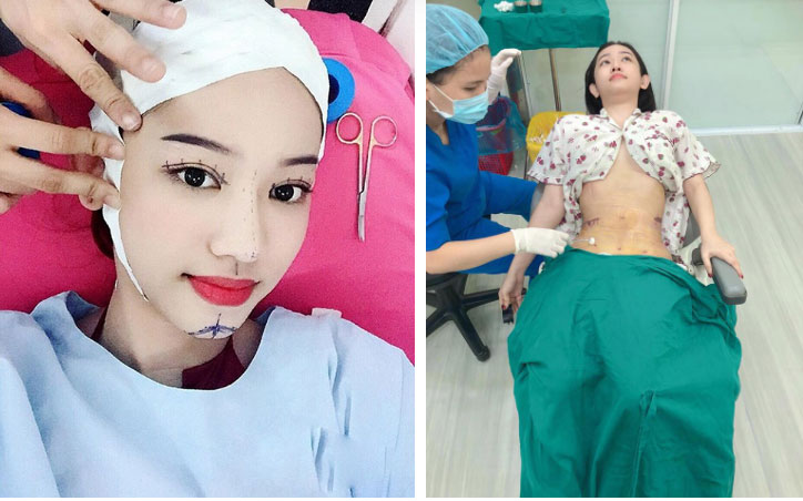 Thúy Vi không tiếc tay chi tiền tỷ phẫu thuật thẩm mỹ, nhưng lại nhận mình là hot girl sống khổ nhất Việt Nam-3