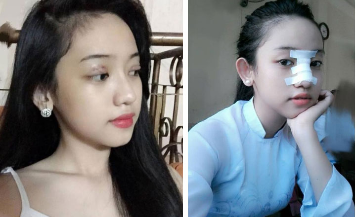 Thúy Vi không tiếc tay chi tiền tỷ phẫu thuật thẩm mỹ, nhưng lại nhận mình là hot girl sống khổ nhất Việt Nam-4