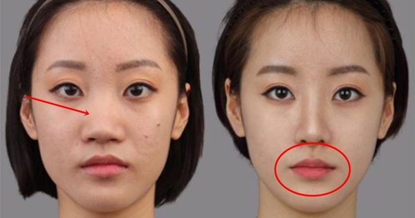 4 bộ phận trên cơ thể đừng dại mà phẫu thuật nếu không muốn phá tướng, đuổi hết tài lẫn lộc-1