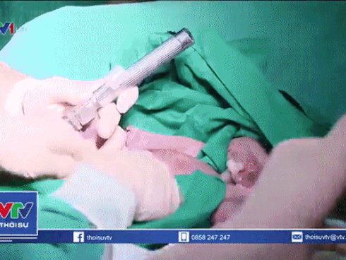 TP.HCM: Mổ khẩn cứu bé sơ sinh nguy kịch trong bụng mẹ vì động mạch phổi nằm sai vị trí-7