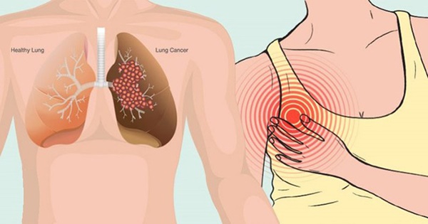 4 lời báo động từ cơ thể cảnh báo tế bào ung thư đang tấn công, sức đề kháng giảm sút-1