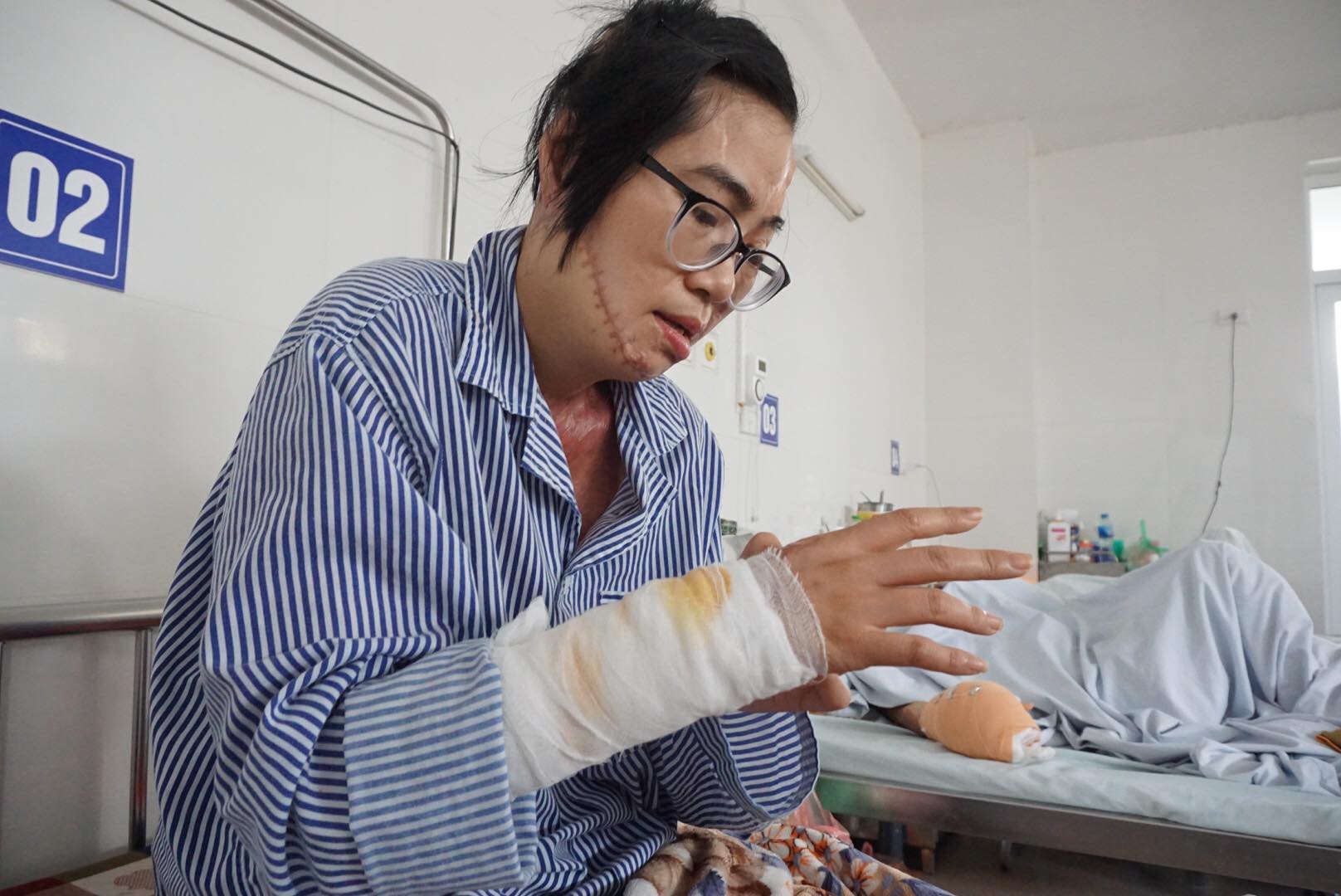 Cô giáo bị chồng tạt axit biến dạng khuôn mặt và tâm sự chua xót của người cha sau 21 lần phẫu thuật của con gái-3