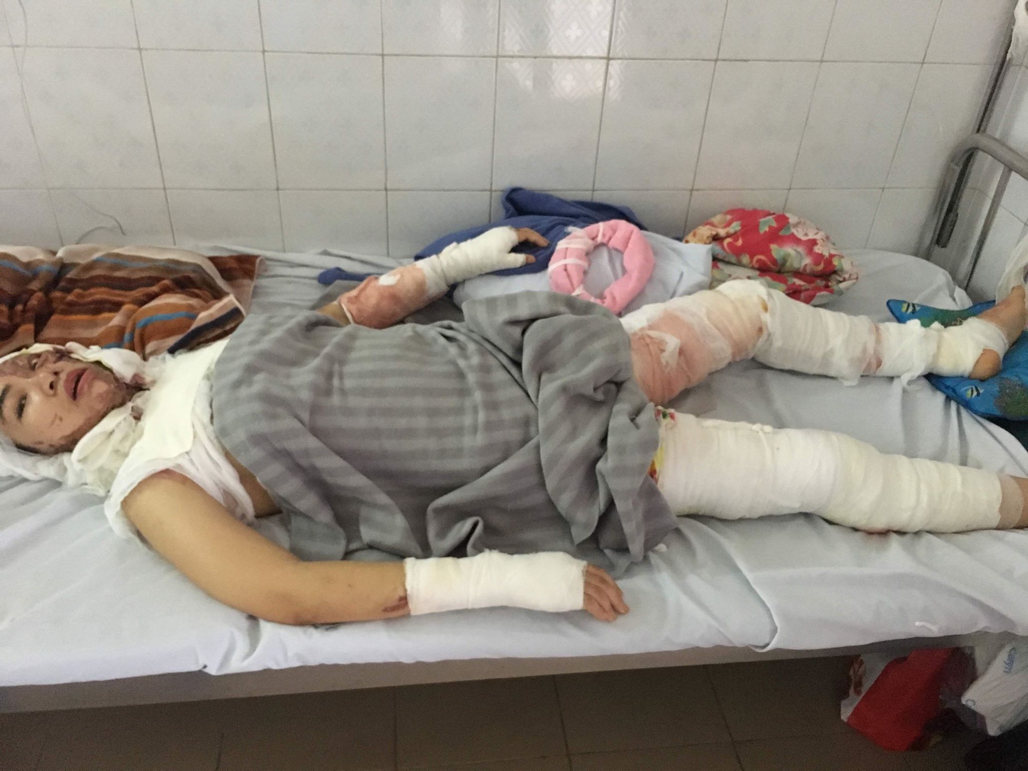 Cô giáo bị chồng tạt axit sau 21 lần phẫu thuật cay đắng nói về sai lầm trong hôn nhân nhiều người mắc phải-2