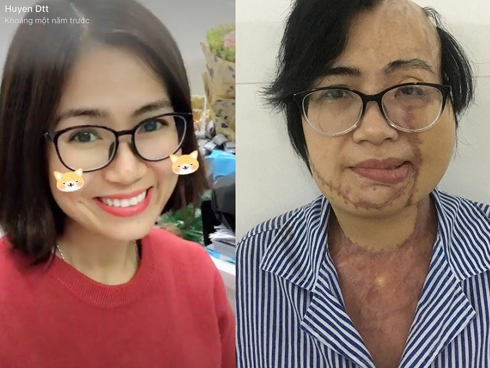 Sau khi ký vào tờ giấy kết hôn định mệnh, cô gái bị chồng sắp cưới tạt axit dọa: Em mà không lấy tôi thì cả đời này đừng mong lấy ai-6