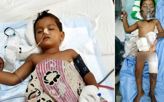 Bé trai sống sót kì diệu sau khi ngã từ nhà cao tầng và bị cây sắt dài 1,8m xuyên qua người-1