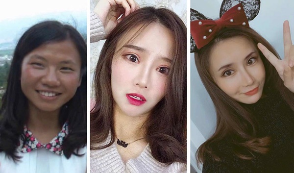 Những cô gái đập mặt xây lại ở Trung Quốc: Đời sang trang nhờ diện mạo mới đến nỗi xem bác sĩ thẩm mỹ là cha mẹ thứ 2-1